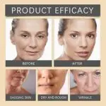 OUHOE – Bee Venom Botox Wrinkle Cream